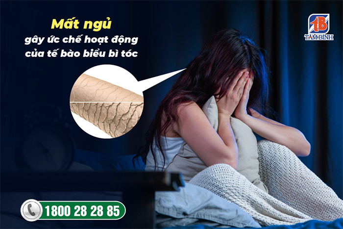 Mất ngủ gây ức chế hoạt động của tế bào biểu bì tóc