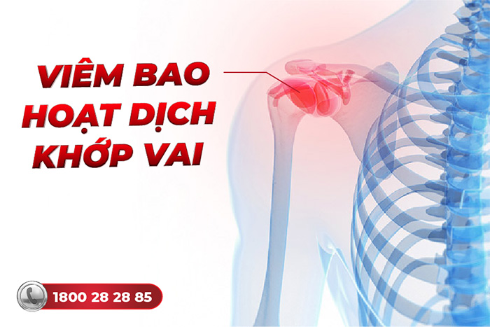 viêm khớp ức đòn là hệ quả của các bệnh lý khác