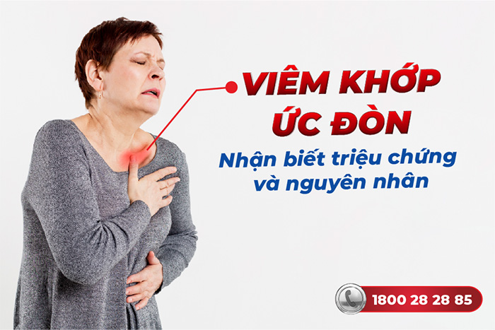 Viêm khớp ức đòn là gì