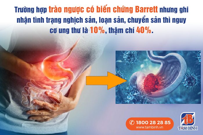 Biến chứng Barrett có nguy cơ ung thư ở người bị trào ngược dạ dày 