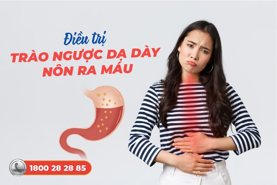 điều trị trào ngược dạ dày nôn ra máu