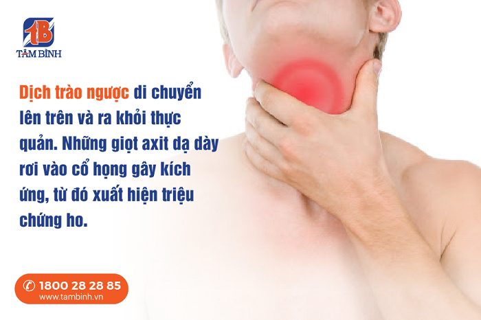 Ho do trào ngược dạ dày thực quản