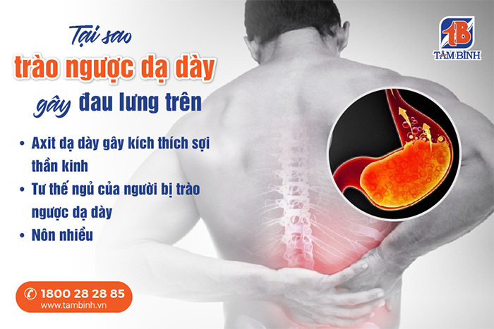 Tại sao trào ngược dạ dày gây đau lưng trên