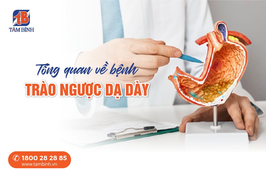 trào ngược dạ dày