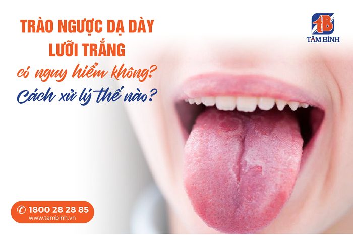 trào ngược dạ dày lưỡi trắng 