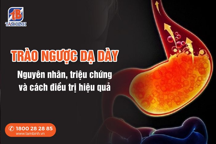 trào ngược dạ dày