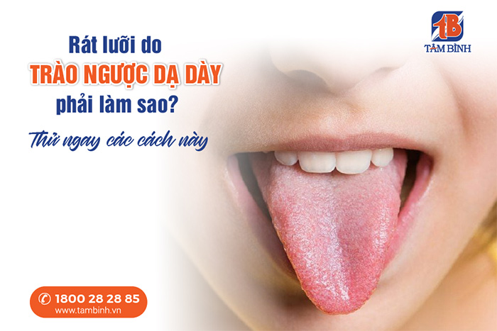 Rát lưỡi do trào ngược dạ dày là gì