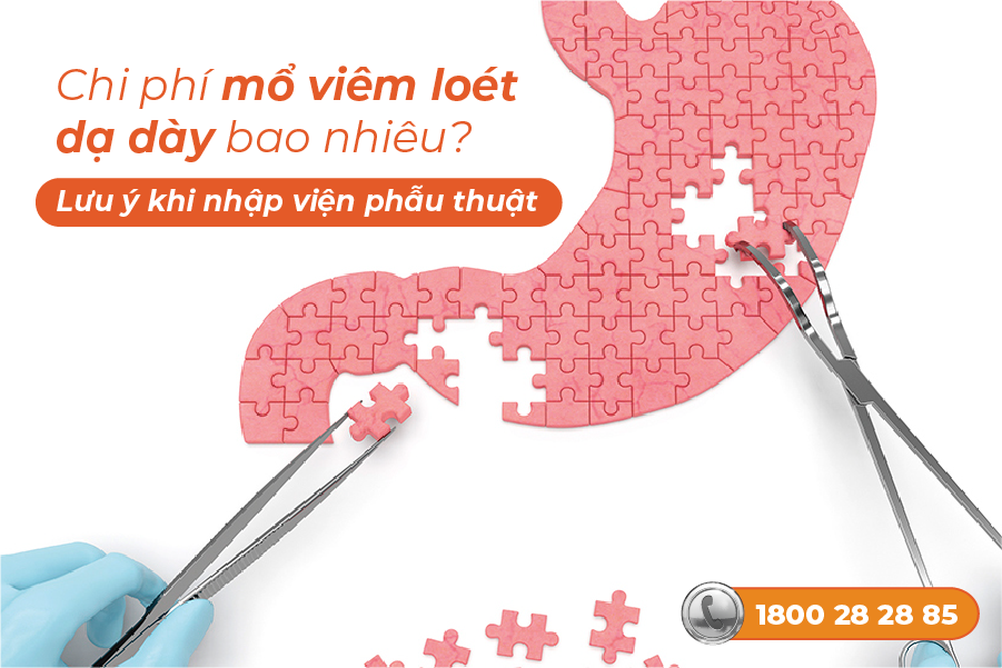 chi phí mổ viêm loét dạ dày