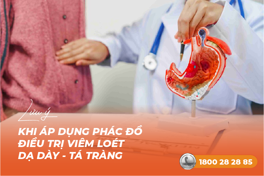 lưu ý khi áp dụng phác đồ điều trị viêm loét dạ dày tá tràng