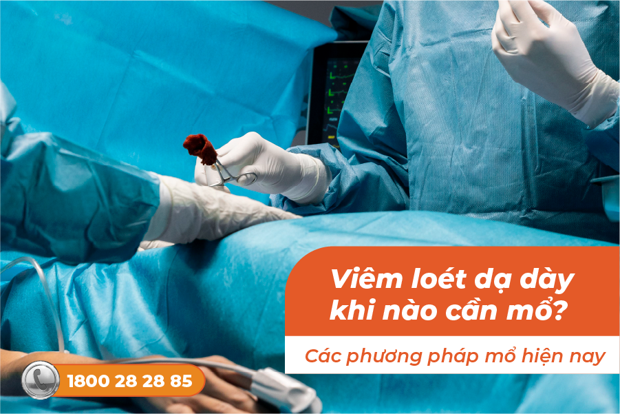 khi nào cần mổ viêm loét dạ dày