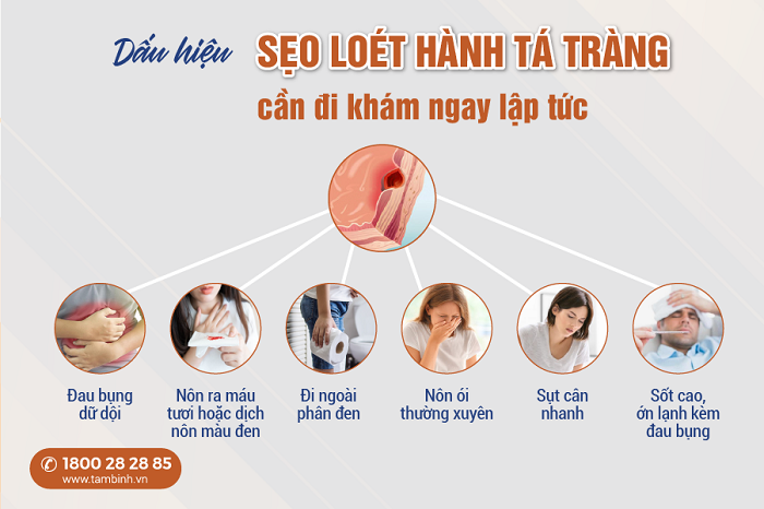Sẹo loét hành tá tràng có nguy hiểm không? Giải đáp chi tiết