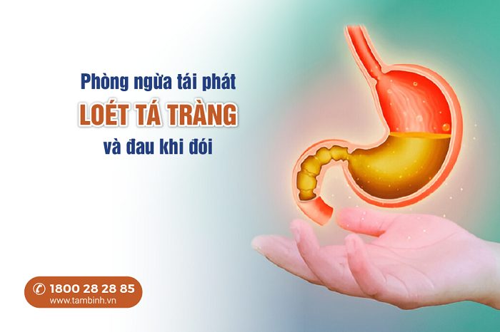 Tại sao loét tá tràng đau khi đói? 4 Cách giảm đau nhanh và an toàn