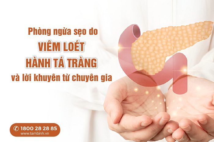 Sẹo loét hành tá tràng có nguy hiểm không? Giải đáp chi tiết