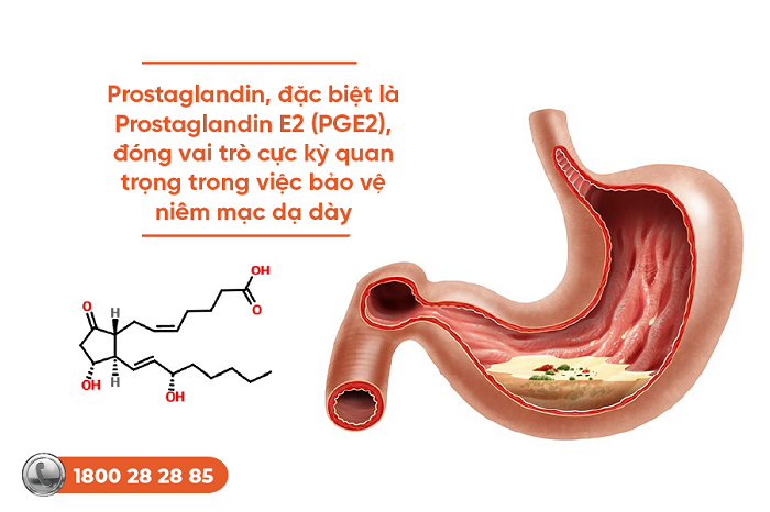 Cơ chế bệnh sinh của loét dạ dày tá tràng: Giải thích chi tiết từ chuyên gia