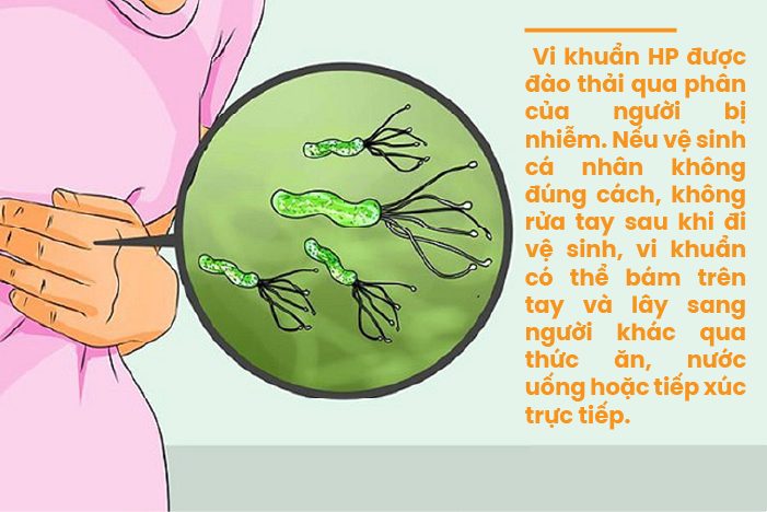 HP dạ dày có lây không: Lây qua đường nào? 4 đường lây phổ biến nhất HP dạ dày có lây không: Lây qua đường nào? 4 đường lây phổ biến nhất