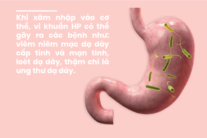 HP dạ dày có lây không: Lây qua đường nào? 4 đường lây phổ biến nhất HP dạ dày có lây không: Lây qua đường nào? 4 đường lây phổ biến nhất