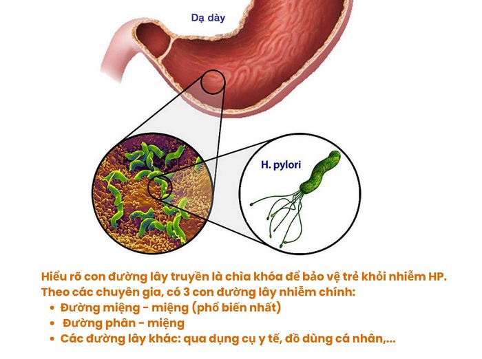 Vi khuẩn HP có lây cho trẻ em không? Dấu hiệu sớm cha mẹ cần biết Vi khuẩn HP có lây cho trẻ em không? Dấu hiệu sớm cha mẹ cần biết